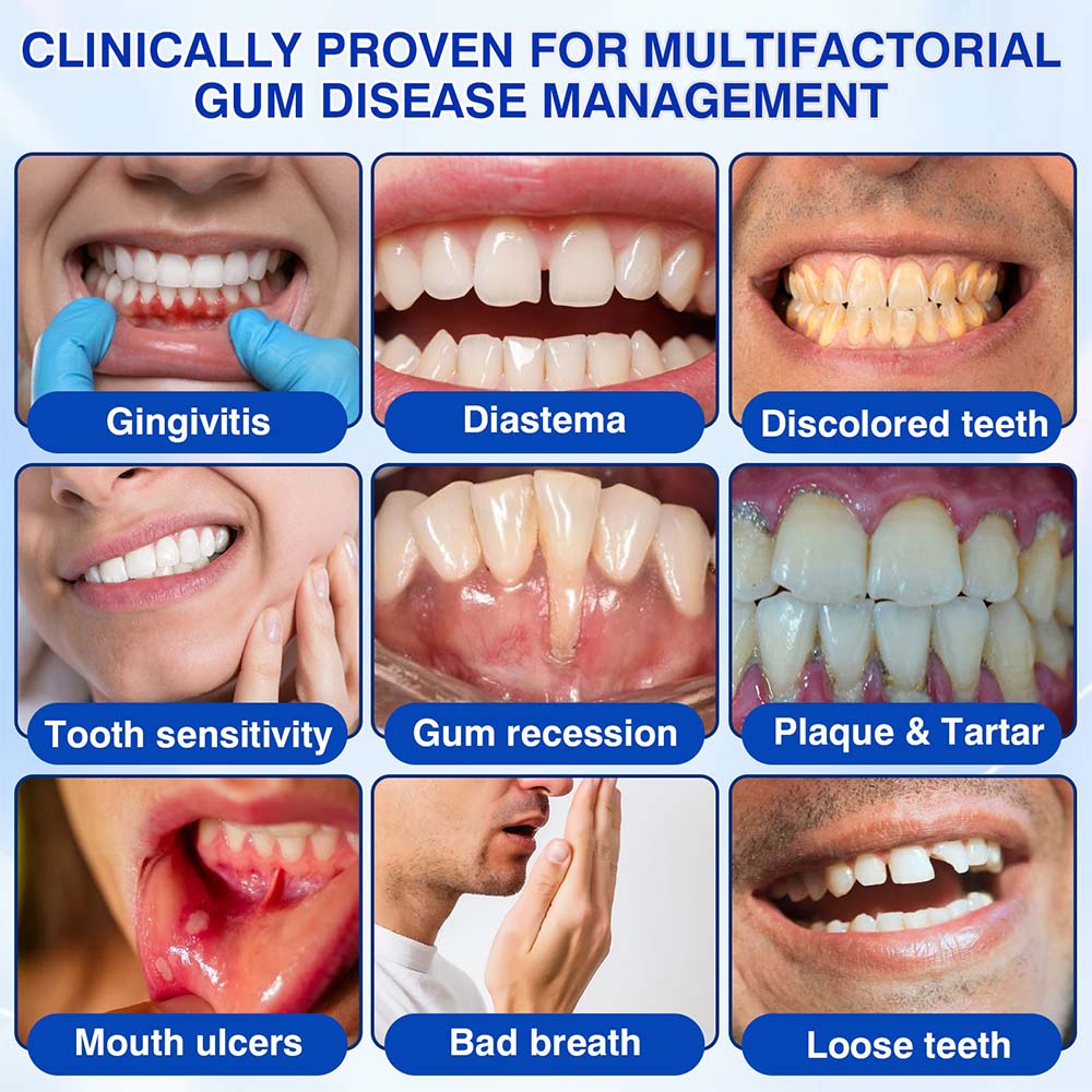 Healrize® 🦷GumRevive gel for the regeneration of the tooth-supporting apparatus🪙 (for bleeding gums, receding gums, and loose teeth)🪙