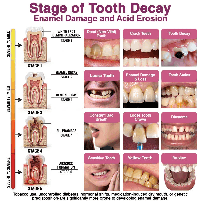 🦷🦢Healrize® Cavity-Repair Natural Enamel Filling Gel