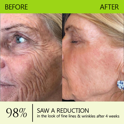 Made and shipped from UK👉💝Healrize® Botox & Vita-A Retinol Shot Wrinkle-Lift Tightening cream - Last Day Promotion 60% OFF💝