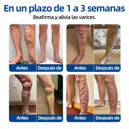 𝗛𝗲𝗮𝗹𝗿𝗶𝘇𝗲® 𝗣𝗮𝗿𝗰𝗵𝗲 𝗠𝗶𝗰𝗿𝗼𝗻𝗲𝗲𝗱𝗹𝗲 𝗩𝗲𝗶𝗻𝗧𝗮𝗿𝗴𝗲𝘁 𝗔𝗹𝗶𝘃𝗶𝗼 𝗜𝗻𝘀𝘁𝗮𝗻𝘁𝗮́𝗻𝗲𝗼, 𝗥𝗲𝘀𝘂𝗹𝘁𝗮𝗱𝗼𝘀 𝗮 𝗟𝗮𝗿𝗴𝗼 𝗣𝗹𝗮𝘇𝗼🌾🌿🇪🇸