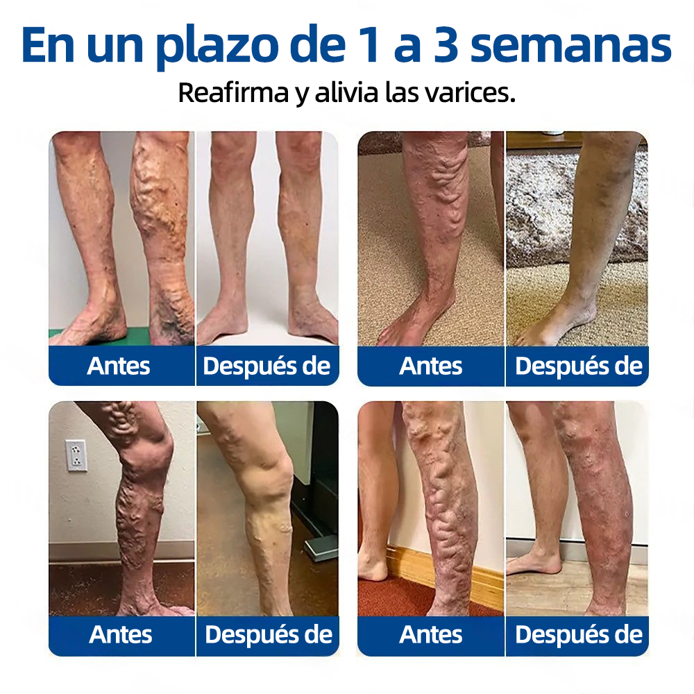 𝗛𝗲𝗮𝗹𝗿𝗶𝘇𝗲® 𝗣𝗮𝗿𝗰𝗵𝗲 𝗠𝗶𝗰𝗿𝗼𝗻𝗲𝗲𝗱𝗹𝗲 𝗩𝗲𝗶𝗻𝗧𝗮𝗿𝗴𝗲𝘁 𝗔𝗹𝗶𝘃𝗶𝗼 𝗜𝗻𝘀𝘁𝗮𝗻𝘁𝗮́𝗻𝗲𝗼, 𝗥𝗲𝘀𝘂𝗹𝘁𝗮𝗱𝗼𝘀 𝗮 𝗟𝗮𝗿𝗴𝗼 𝗣𝗹𝗮𝘇𝗼🌾🥬🇪🇸