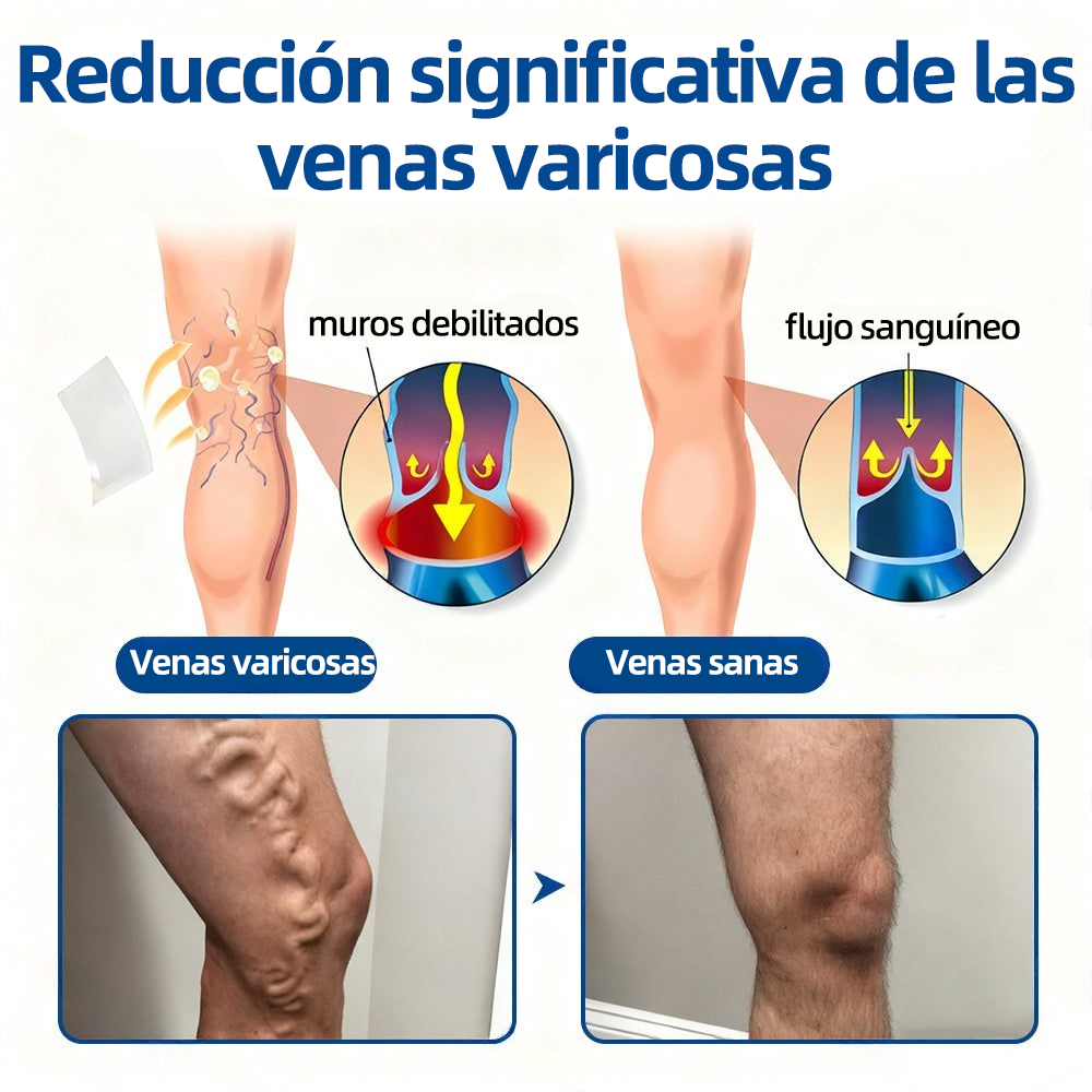 𝗛𝗲𝗮𝗹𝗿𝗶𝘇𝗲® 𝗣𝗮𝗿𝗰𝗵𝗲 𝗠𝗶𝗰𝗿𝗼𝗻𝗲𝗲𝗱𝗹𝗲 𝗩𝗲𝗶𝗻𝗧𝗮𝗿𝗴𝗲𝘁 𝗔𝗹𝗶𝘃𝗶𝗼 𝗜𝗻𝘀𝘁𝗮𝗻𝘁𝗮́𝗻𝗲𝗼, 𝗥𝗲𝘀𝘂𝗹𝘁𝗮𝗱𝗼𝘀 𝗮 𝗟𝗮𝗿𝗴𝗼 𝗣𝗹𝗮𝘇𝗼🌾🥬🇪🇸