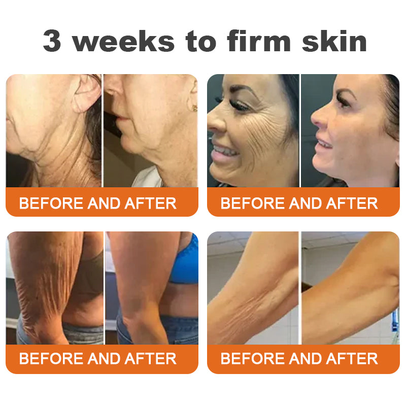 Made and Shipped from UK✨Awzlove® Botox Bee Venom Firming Serum Stick(🔥LAST DAY 80% OFF)💄