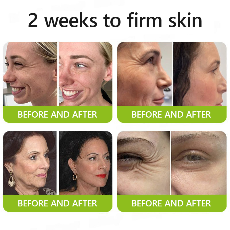 Made and shipped from UK👉💝Healrize® Botox & Vita-A Retinol Shot Wrinkle-Lift Tightening cream - Last Day Promotion 60% OFF💝