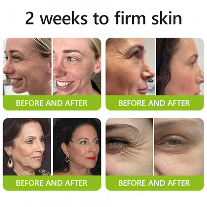 Made and shipped from UK👉💝Healrize® Botox & Vita-A Retinol Shot Wrinkle-Lift Tightening cream - Last Day Promotion 60% OFF💝