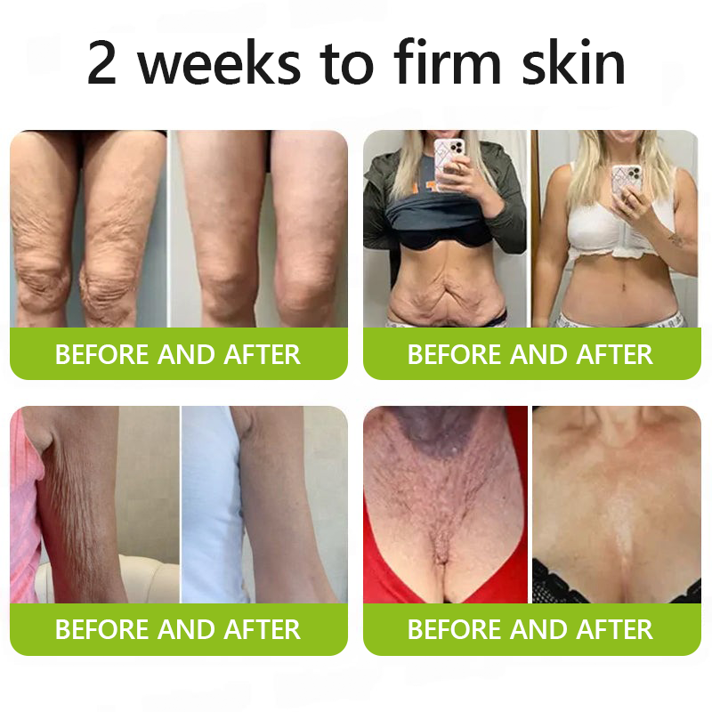 Made and shipped from UK👉💝Healrize® Botox & Vita-A Retinol Shot Wrinkle-Lift Tightening cream - Last Day Promotion 60% OFF💝