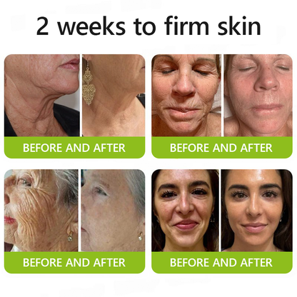 Made and shipped from UK👉💝Healrize® Botox & Vita-A Retinol Shot Wrinkle-Lift Tightening cream - Last Day Promotion 60% OFF💝