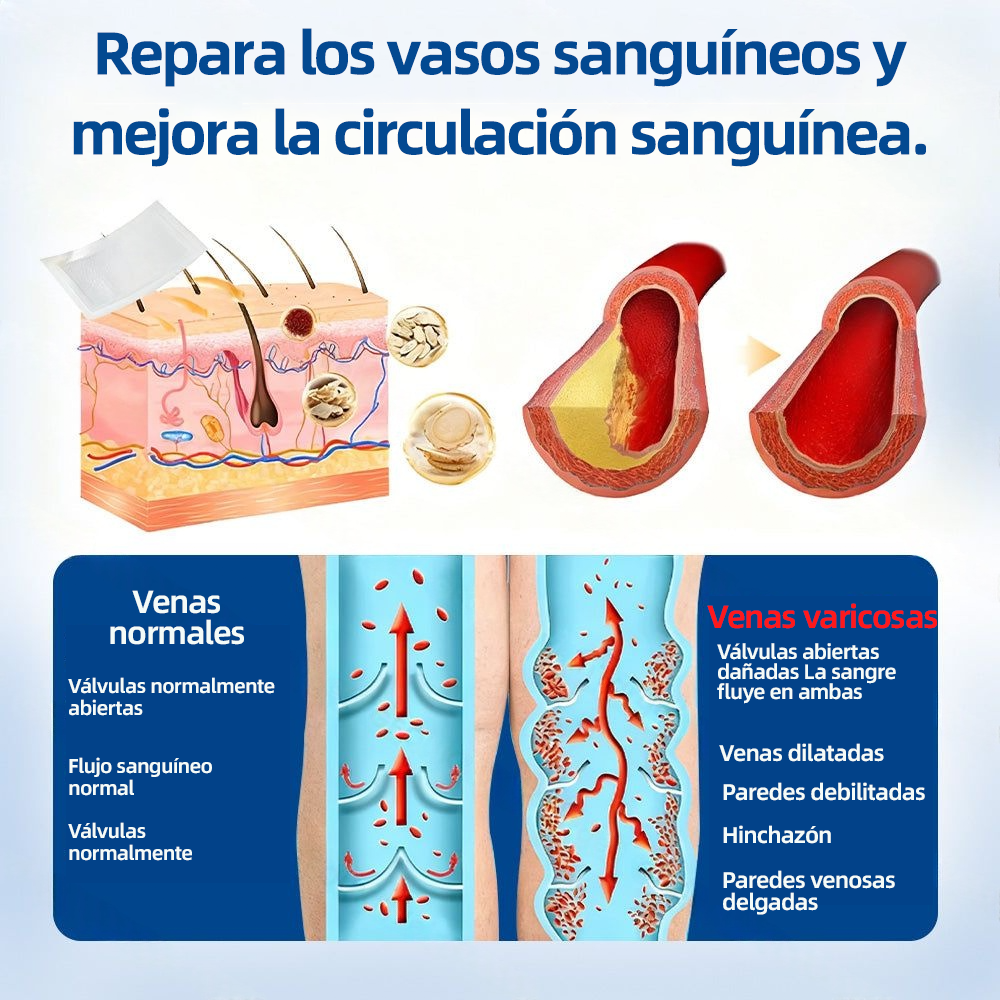 🇪🇸👨‍⚕️Healrize® Parche Microneedle VeinTarget Alivio Instantáneo, Resultados a Largo Plazo🦵🍀